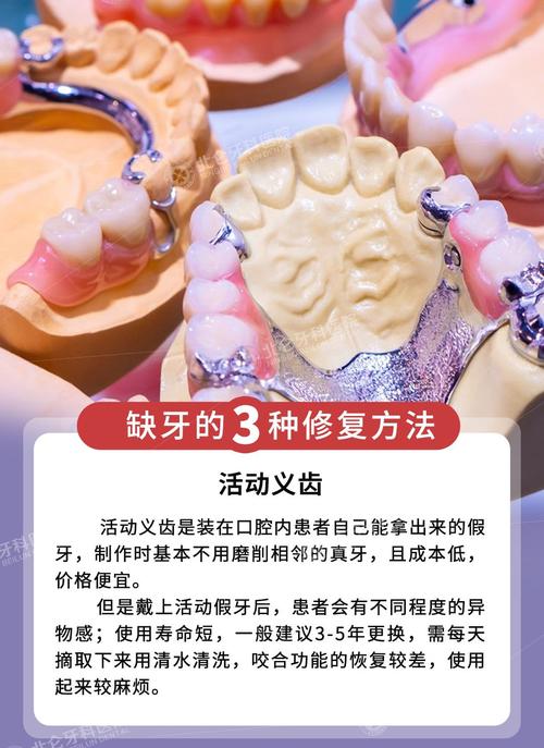 种牙植骨后补什么恢复快-图3