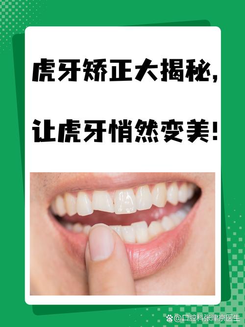 正畸推虎牙治疗方式-图3