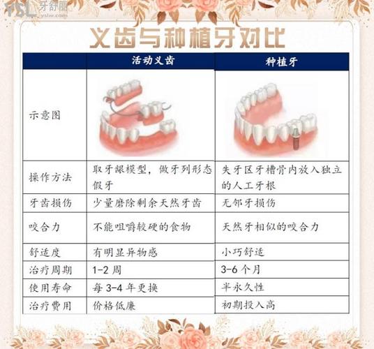 镶牙和植牙的区别 价格-图3