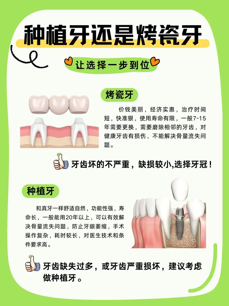 门牙黑，烤瓷牙和种植牙怎么选？-图2