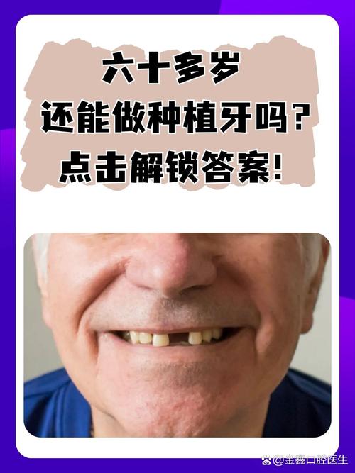 中老年植牙一般指的是哪些牙齿？-图1