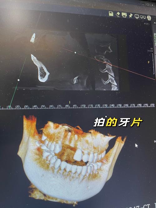 北京德贝植牙被曝黑骗，真相究竟如何？-图2