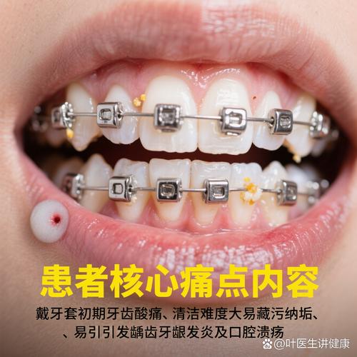 安全正畸 牙周护航-图3