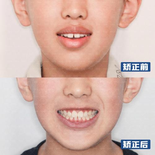 张栋梁教授正畸团队-图1