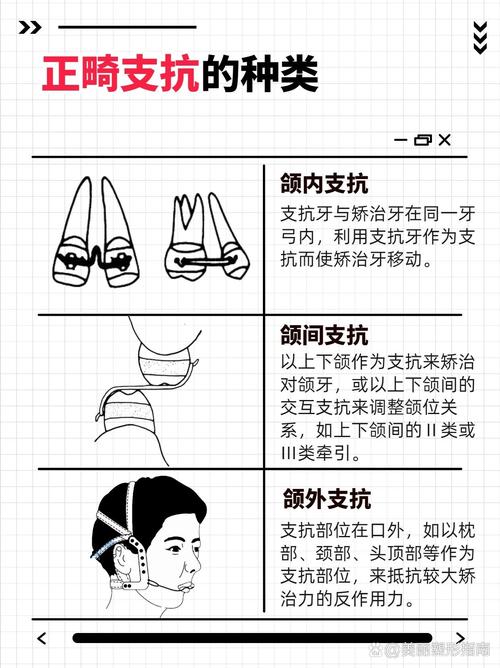 正畸生理性支抗技术相较于传统支抗有何独特优势？-图1