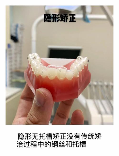 正畸托槽怎么取下?取下过程、方法及注意事项全解析?-图2 正畸托槽怎么取下?取下过程、方法及注意事项全解析?-图2