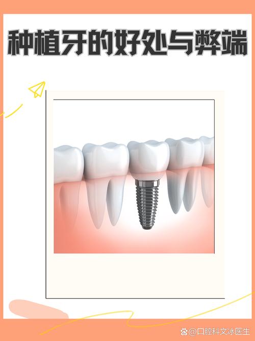 第三代植牙是什么意思-图2 第三代植牙是什么意思-图2