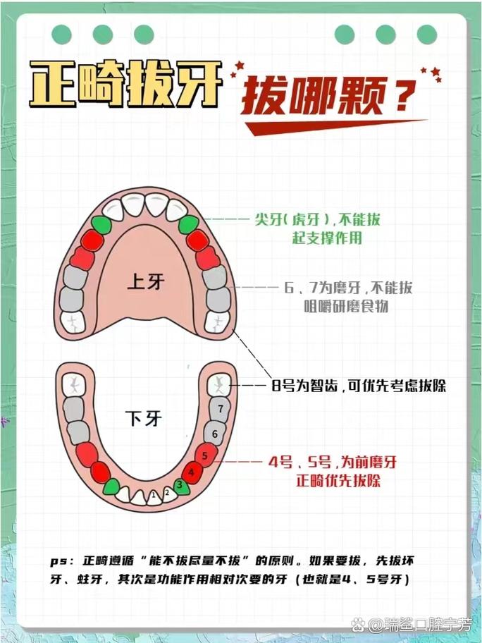 正畸拔牙顺序如何才科学？分步进行有何讲究？-图1