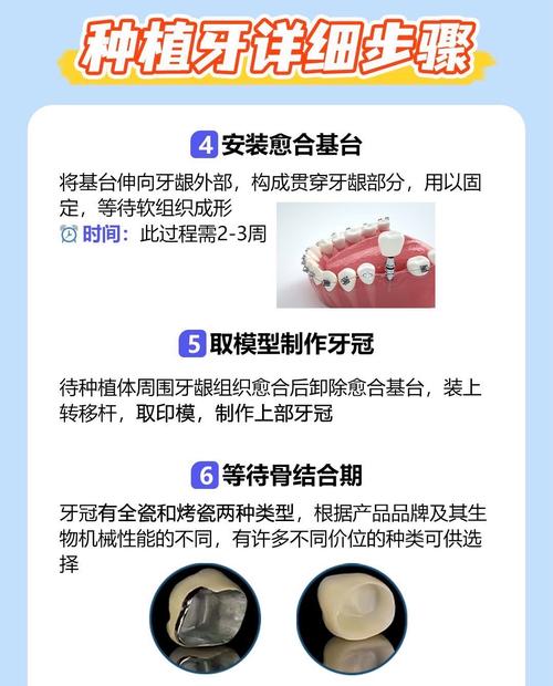 植牙是否人人适用？哪些情况需谨慎？-图1