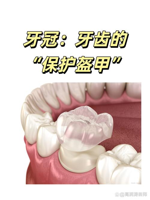 戴牙冠后还能正畸吗?会对牙冠及矫正效果有影响吗?-图3 戴牙冠后还能正畸吗?会对牙冠及矫正效果有影响吗?-图3
