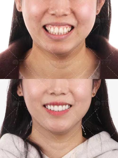 上海去哪里牙齿正畸-图2