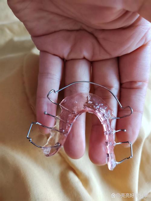 口腔正畸功能保持器有何独特功能与作用？-图2