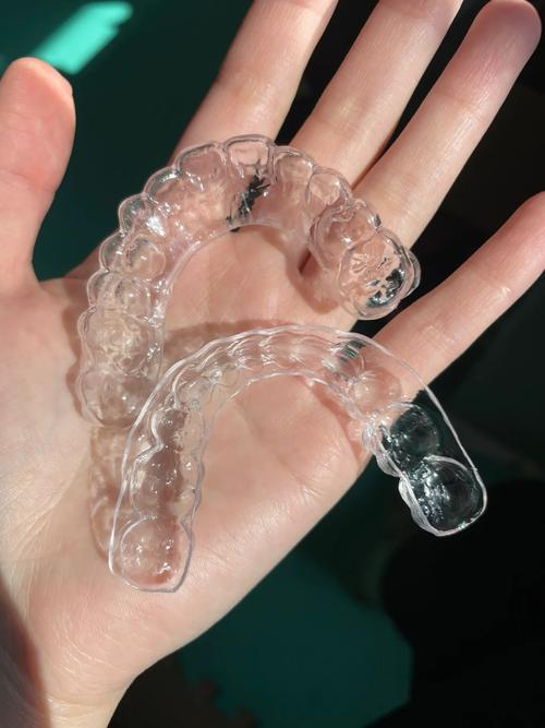 口腔正畸功能保持器有何独特功能与作用？-图1