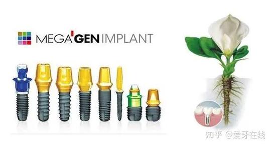 美国3i植体系统种牙效果如何？有哪些优势？适合哪些人？-图1
