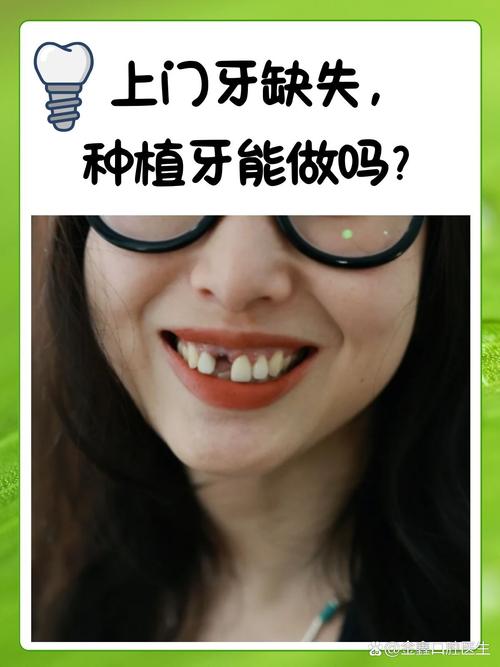 门牙三颗相连能植牙吗？-图2