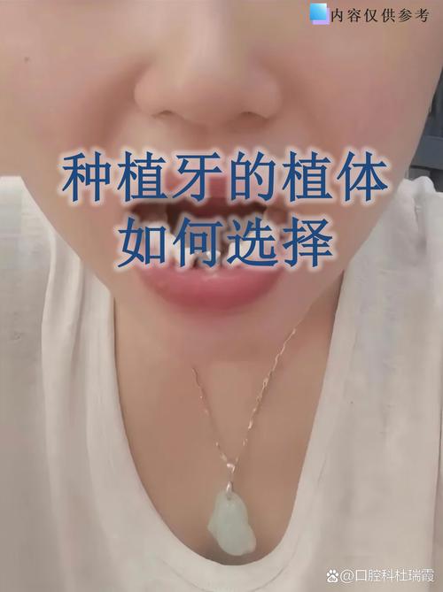 301种植牙成功率高-图1