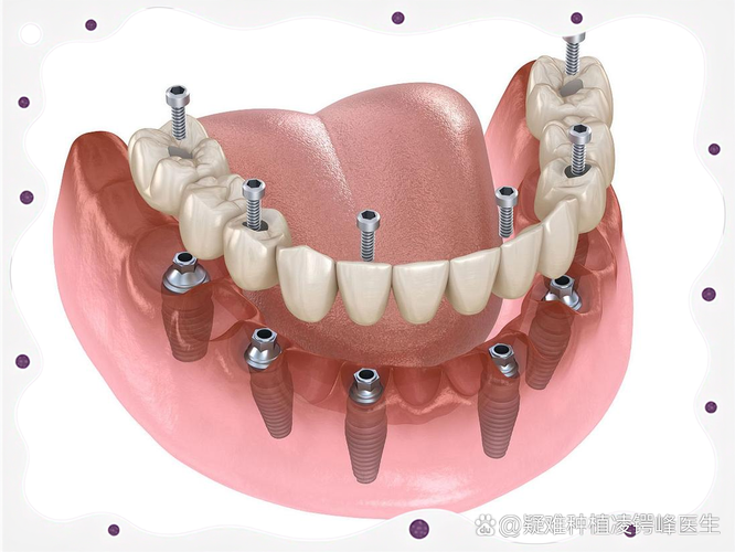 种牙植体后吃什么水果合适？术后饮食要注意啥？-图1