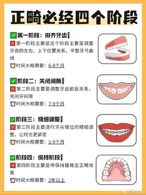 口腔正畸的学科发展-图3 口腔正畸的学科发展-图3