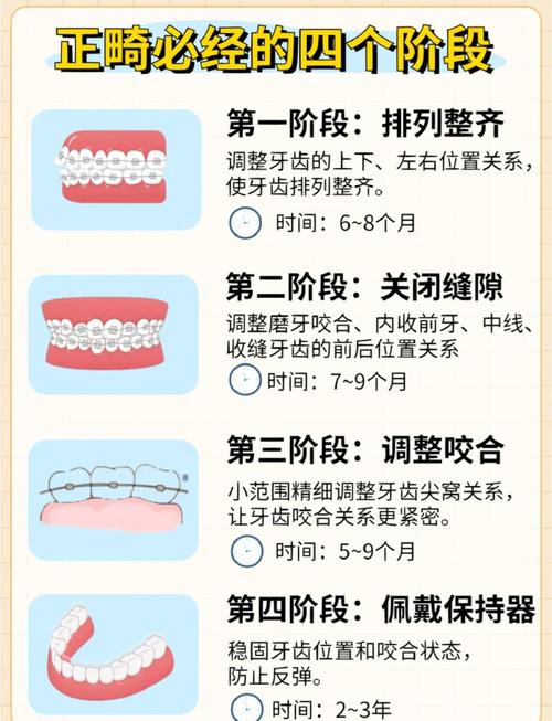 正畸过程需要磨牙吗-图2 正畸过程需要磨牙吗-图2