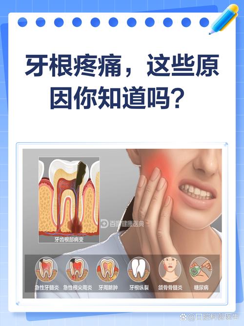 根管治疗VS植牙，到底哪个更疼？-图3