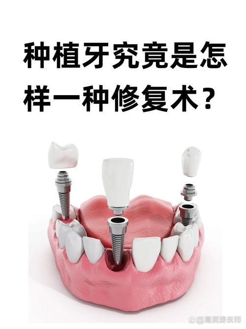 植牙成功的标准究竟包含哪些关键衡量指标？-图2