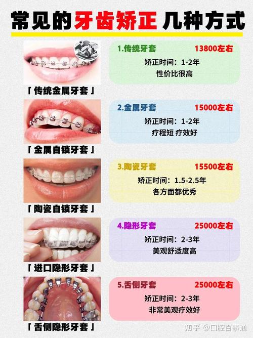 杭州牙齿正畸去哪里-图1 杭州牙齿正畸去哪里-图1