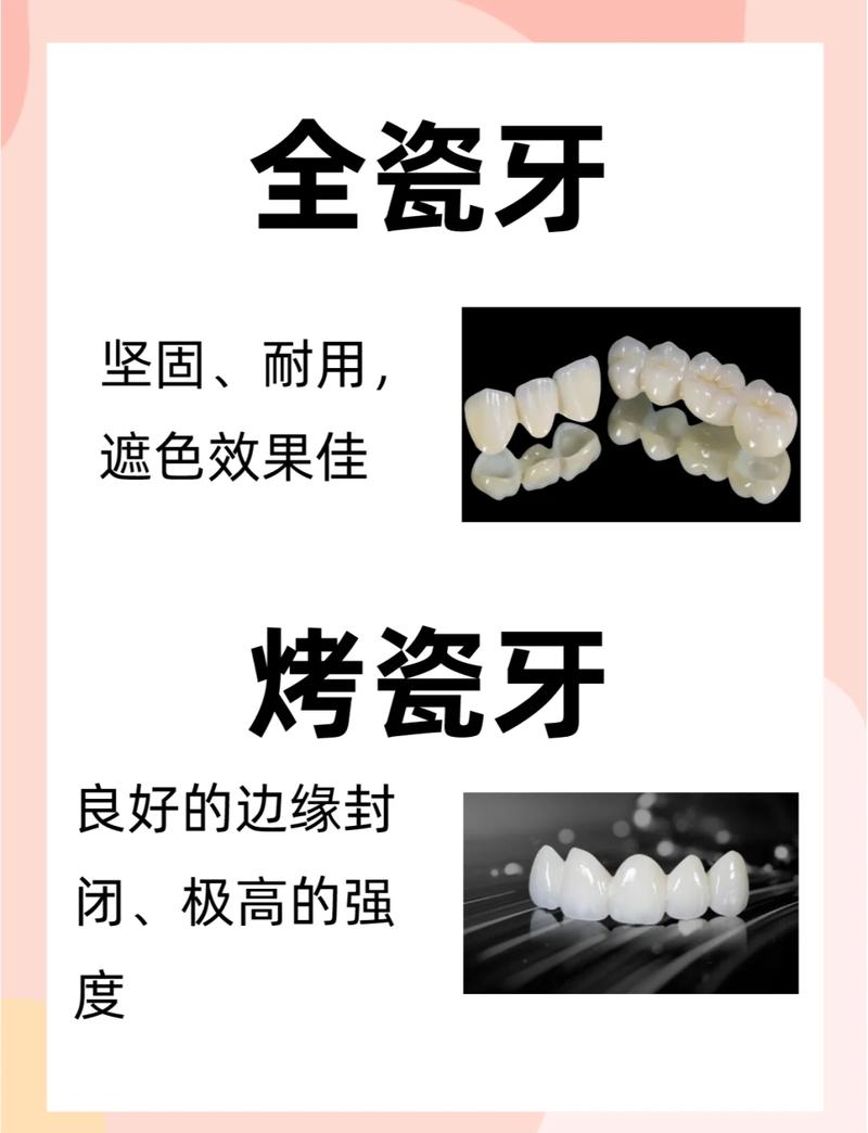 做了烤瓷牙还能做正畸矫正吗？-图2