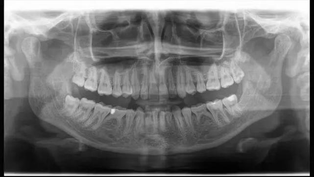 牙齿正畸京icp备-图1