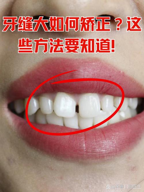 正畸牙缝不能关闭了-图1
