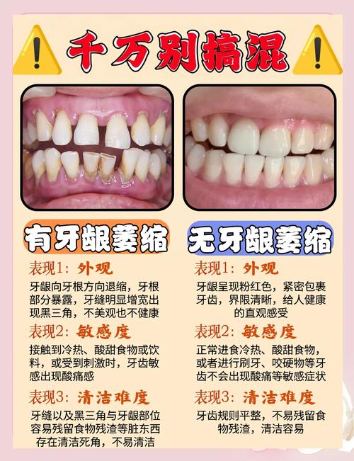 植牙后几天牙龈萎缩了-图3