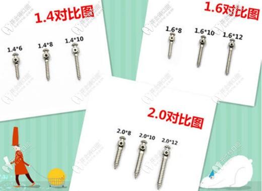 正畸支抗钉常用型号-图2 正畸支抗钉常用型号-图2