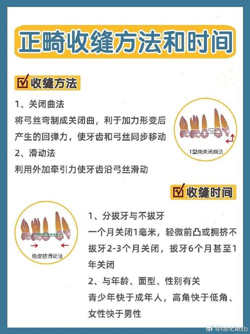 正畸牙怎么关闭缝隙-图2 正畸牙怎么关闭缝隙-图2