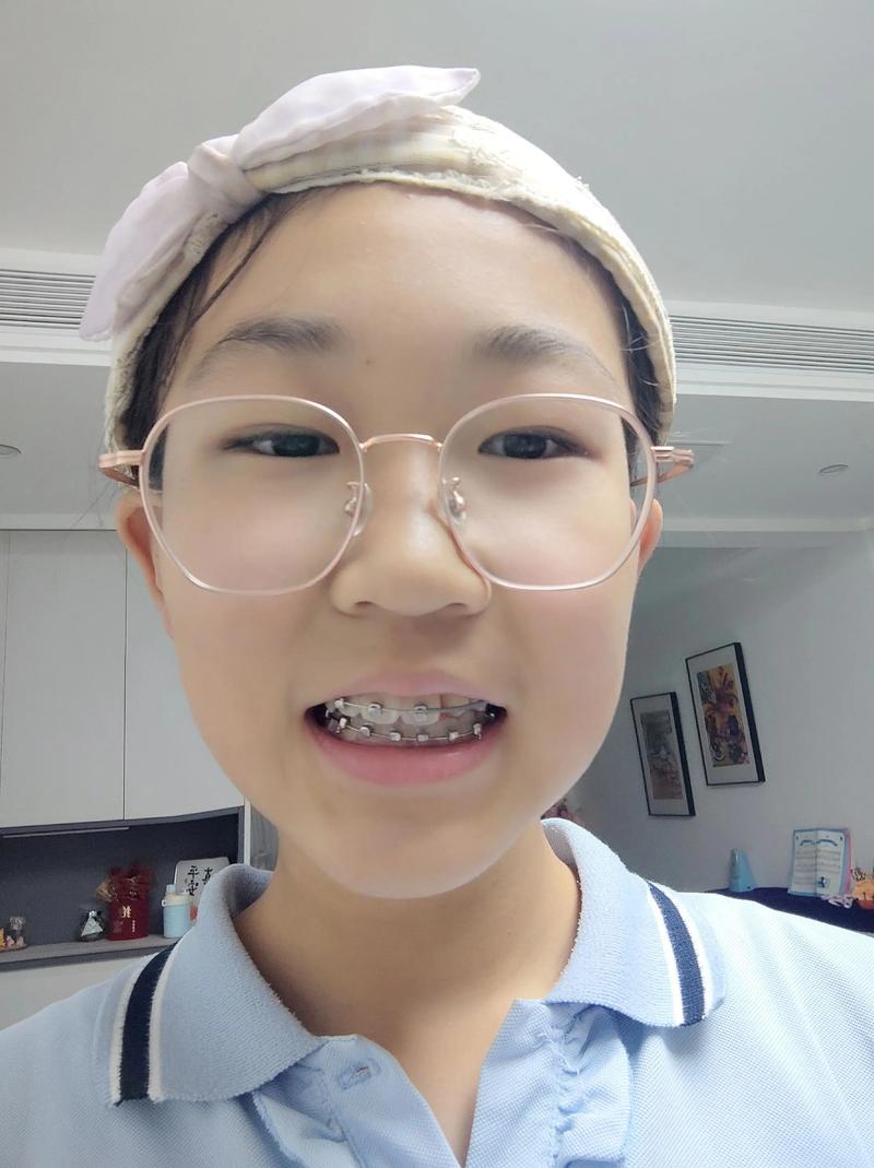 洛阳正畸牙齿矫正哪家好?靠谱机构怎么选?-图2 洛阳正畸牙齿矫正哪家好?靠谱机构怎么选?-图2