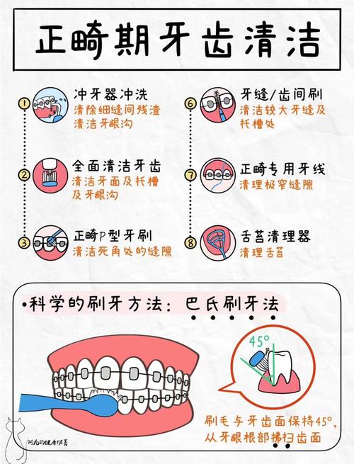 正畸横腭杆怎么刷牙-图1 正畸横腭杆怎么刷牙-图1