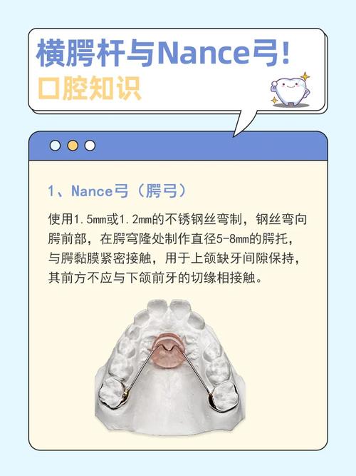 正畸横腭杆怎么刷牙-图3 正畸横腭杆怎么刷牙-图3