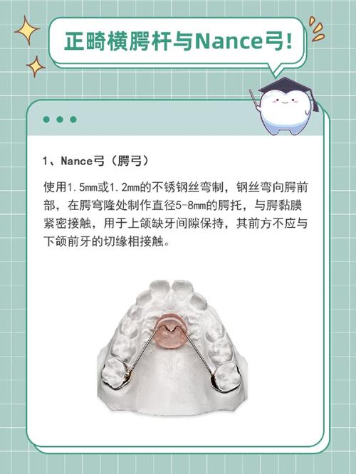 正畸横腭杆怎么刷牙-图2 正畸横腭杆怎么刷牙-图2