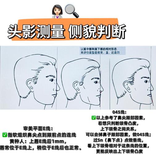 正畸都需要测量哪些关键指标？-图1
