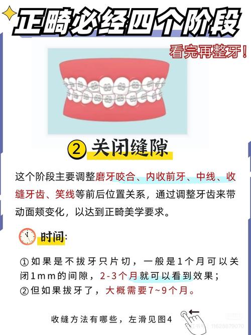 正畸都需要测量哪些关键指标？-图3