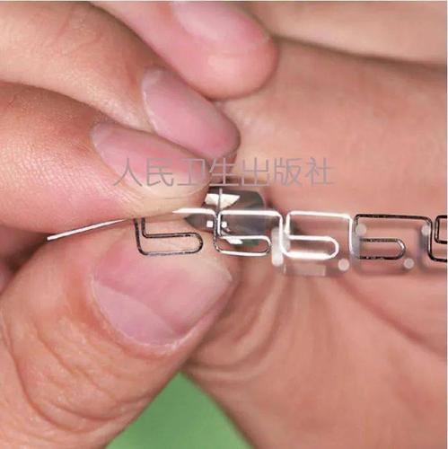 正畸meaw弓弯制的技巧与难点有哪些？-图3