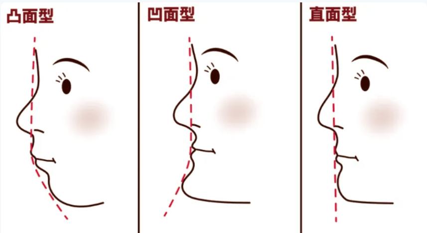正畸测量各角度问题-图1