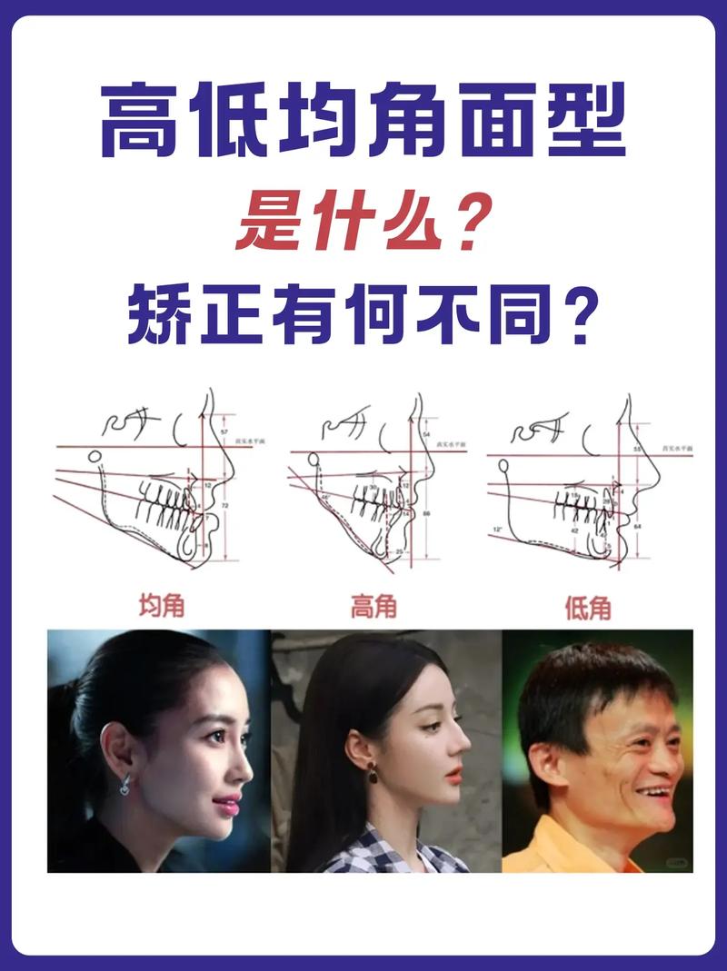 正畸测量各角度问题-图3