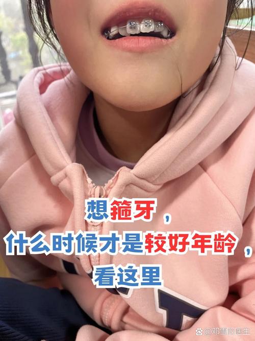 植牙后箍牙,必须拔掉种植牙吗?-图2 植牙后箍牙,必须拔掉种植牙吗?-图2