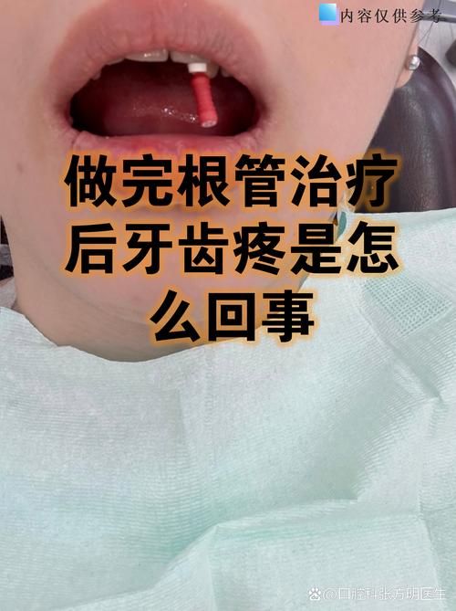 牙槽植骨后植骨区疼痛-图1