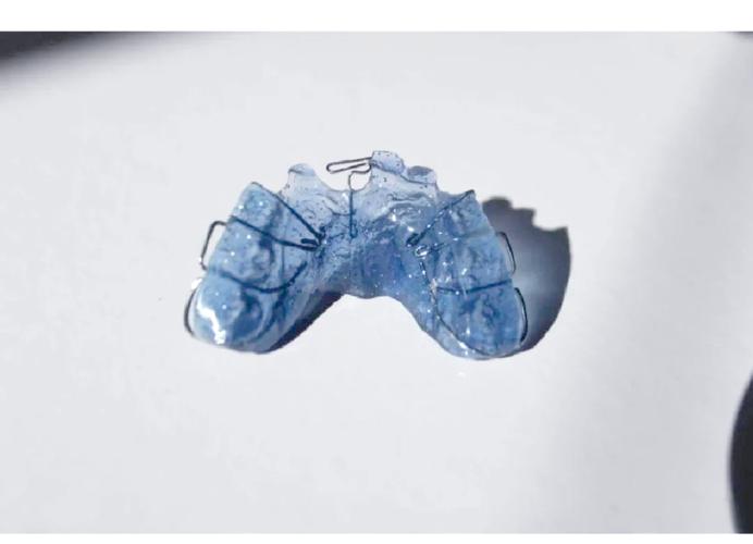 正畸抬高前牙的工具具体有哪些？-图3