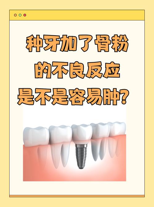 植牙骨粉与植骨有何不同？两者区别到底是什么？-图3