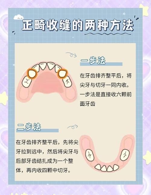 正畸常用的结扎方法有哪些？各自的特点和适用情况是什么？-图1