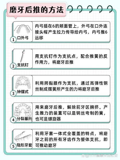 正畸牙齿如何往前推?有效方法与正畸技巧解析-图2 正畸牙齿如何往前推?有效方法与正畸技巧解析-图2