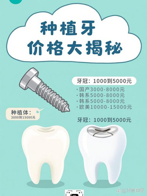 郑州种植牙哪里便宜?这几家报价亲民,靠谱吗?-图2 郑州种植牙哪里便宜?这几家报价亲民,靠谱吗?-图2