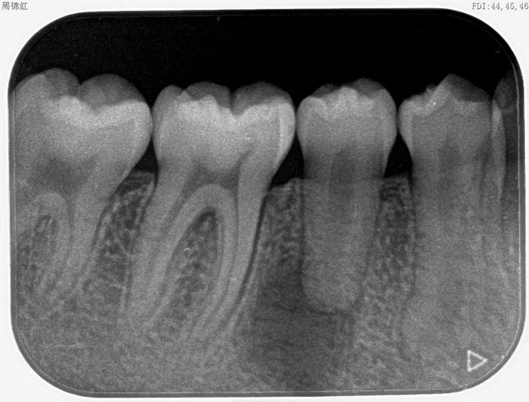 根尖发育发育与正畸-图1