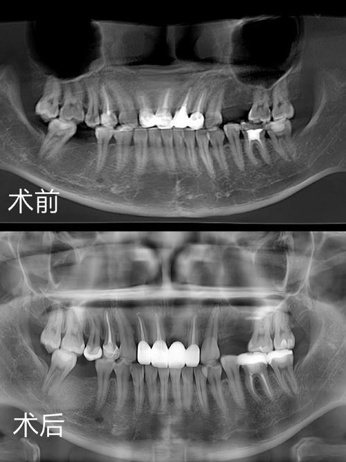 根尖发育发育与正畸-图2